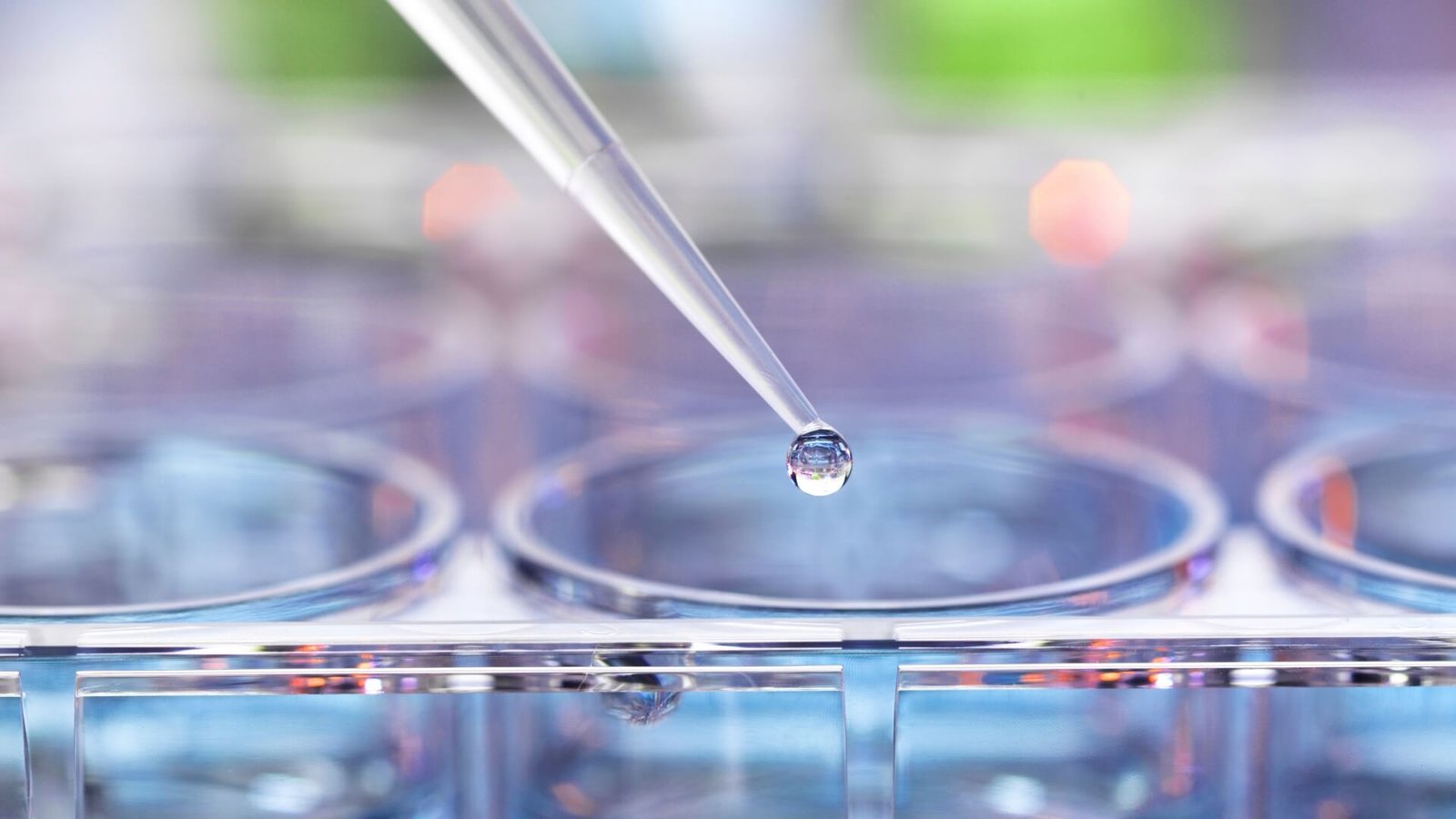 Endometriosis laboratory research and innovation – MZ Medical